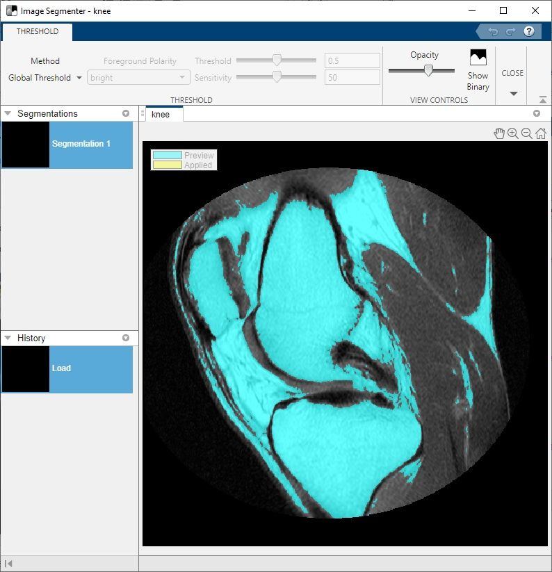 Screenshot of the Image Segmenter app with controls for threshold method and opacity.