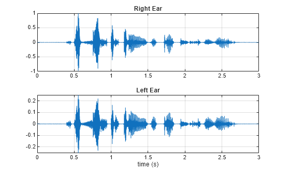 Figure contains 2 axes objects. Axes object 1 with title Right Ear contains an object of type line. Axes object 2 with title Left Ear, xlabel time (s) contains an object of type line.