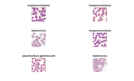 Parasite Classification Using Wavelet Scattering and Deep Learning
