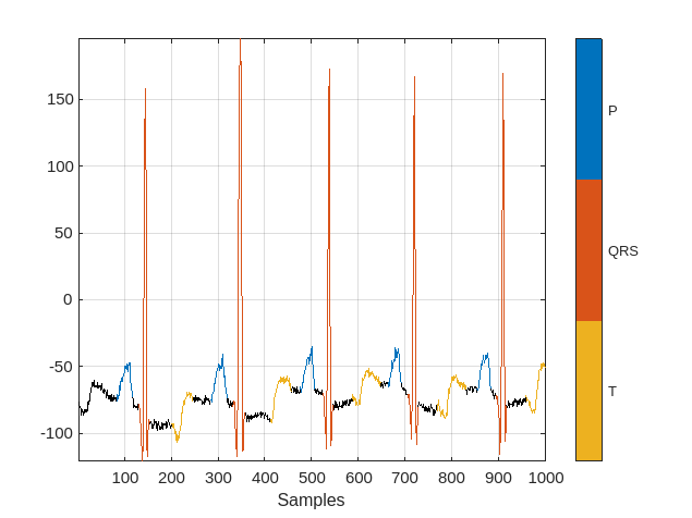 Udgående knus Uhøfligt GPU Algorithm Acceleration - MATLAB & Simulink