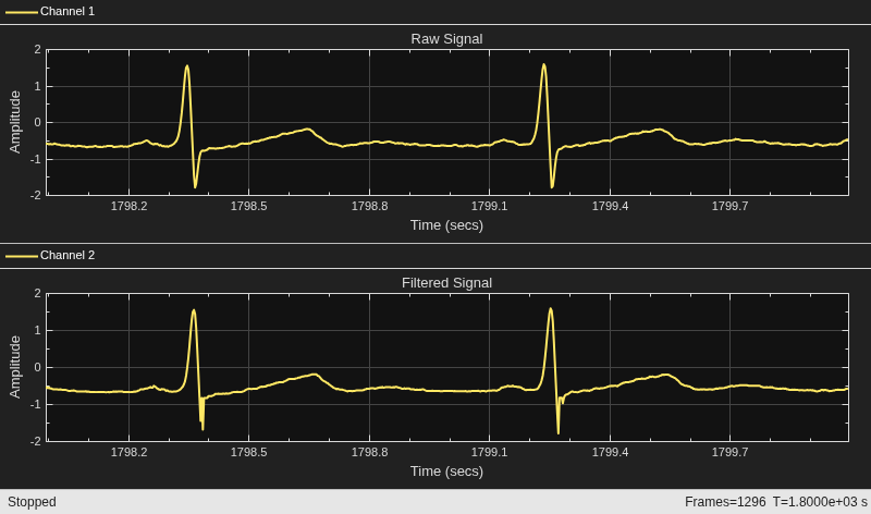 Outlier Removal Techniques with ECG Signals