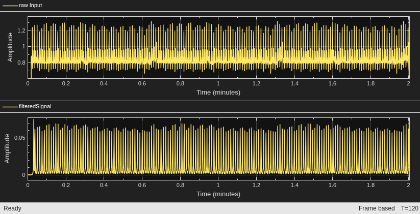 Real-Time ECG QRS Detection