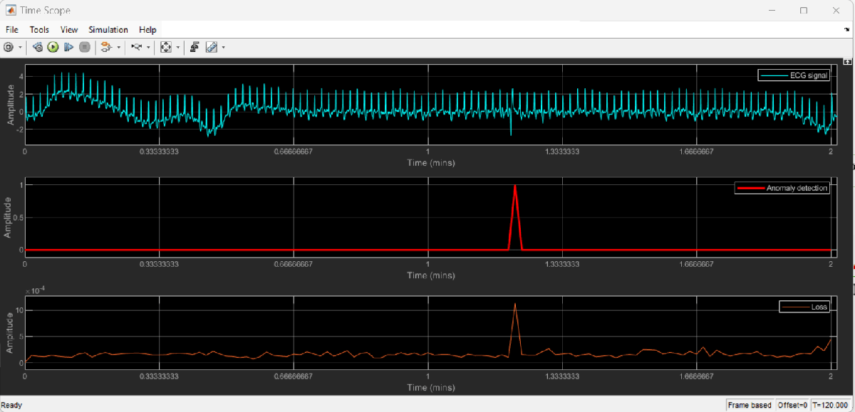 Detect Anomalies in ECG Data Using Wavelet Scattering and LSTM ...