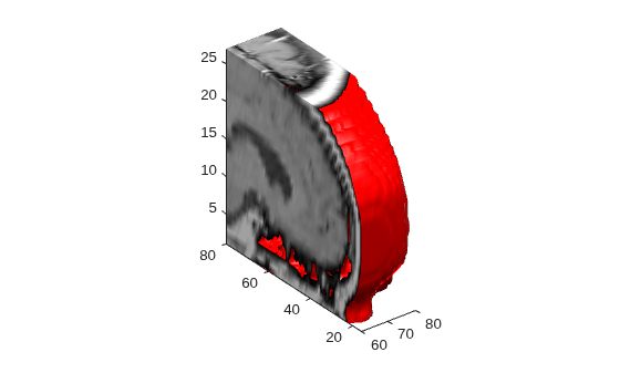 Figure contains an axes object. The axes object contains 2 objects of type patch.