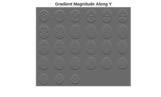 Figure contains an axes object. The hidden axes object with title Gradient Magnitude Along Y contains an object of type image.
