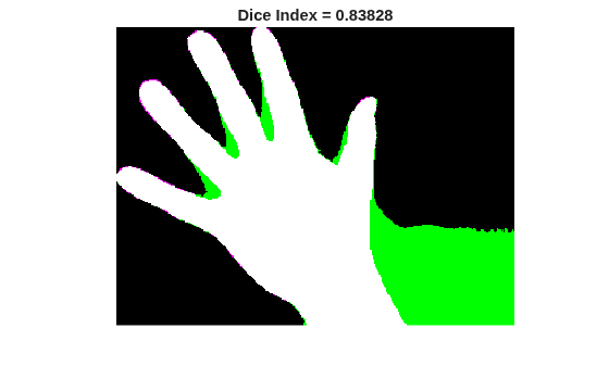 Figure contains an axes object. The hidden axes object with title Dice Index = 0.83828 contains an object of type image.
