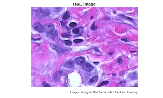 Figure contains an axes object. The hidden axes object with title H&E Image contains 2 objects of type image, text.