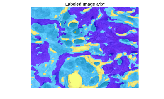 Figure contains an axes object. The hidden axes object with title Labeled Image a*b* contains an object of type image.