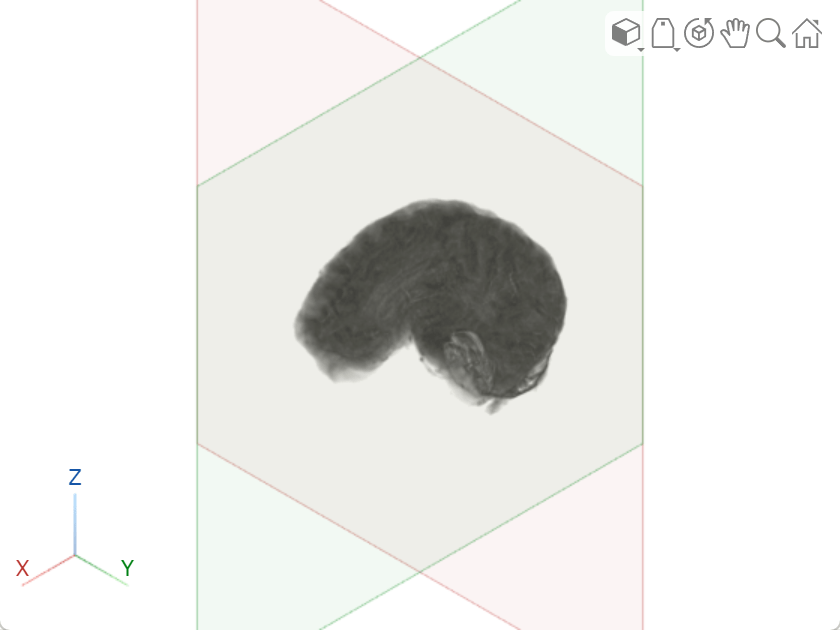 Viewer window, showing the effect of setting the ClipIntersection argument to on. Three quadrants of the brain are visible.