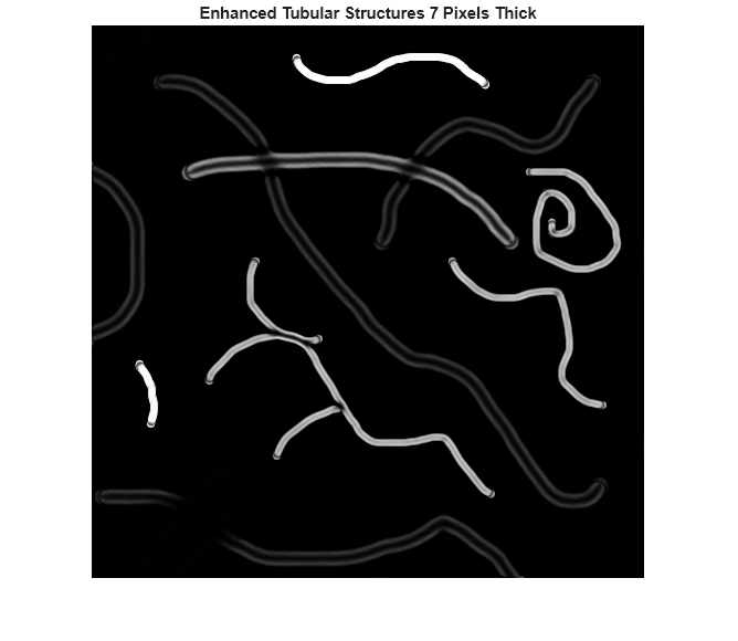 Figure contains an axes object. The hidden axes object with title Enhanced Tubular Structures 7 Pixels Thick contains an object of type image.