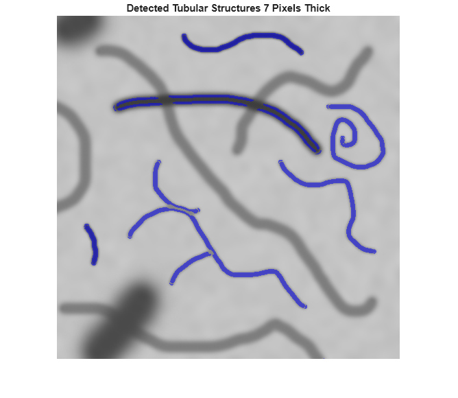 Figure contains an axes object. The hidden axes object with title Detected Tubular Structures 7 Pixels Thick contains an object of type image.