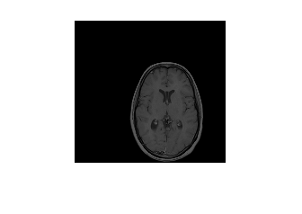 Figure contains an axes object. The hidden axes object contains an object of type image.