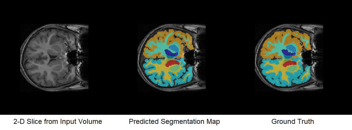 Comparison of Predicted Segmentation Map and Ground Truth Segmentation Map.