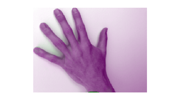 Figure contains an axes object. The hidden axes object contains an object of type image.