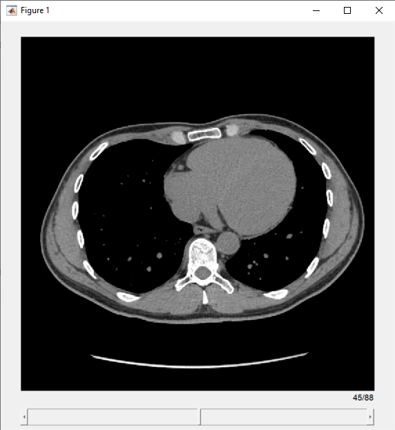 Displaymedicalimagevolumeinsliceviewerexample 01 png