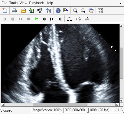 Figure Movie Player contains an axes object and other objects of type uiflowcontainer, uimenu, uitoolbar. The hidden axes object contains an object of type image.
