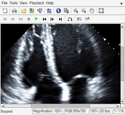 Figure Movie Player contains an axes object and other objects of type uiflowcontainer, uimenu, uitoolbar. The hidden axes object contains an object of type image.