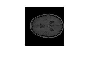 Figure contains an axes object. The hidden axes object contains an object of type image.