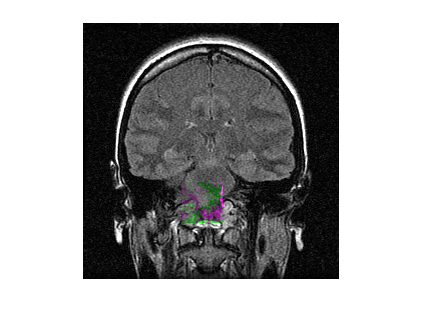 Figure contains an axes object. The hidden axes object contains an object of type image.