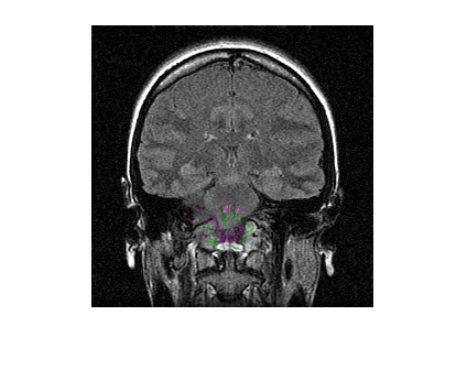 Figure contains an axes object. The hidden axes object contains an object of type image.