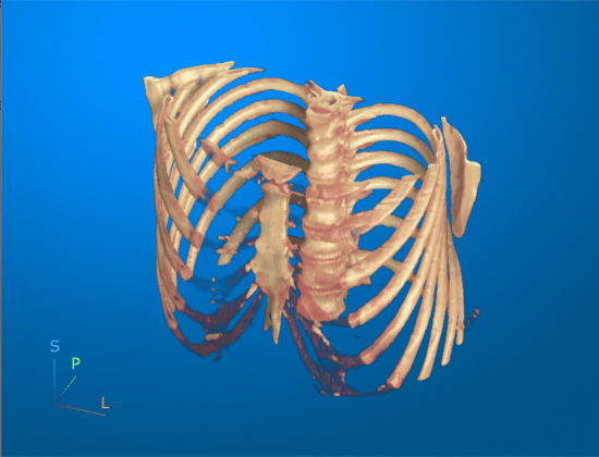 volshow - Display medical volume in patient coordinates - MATLAB
