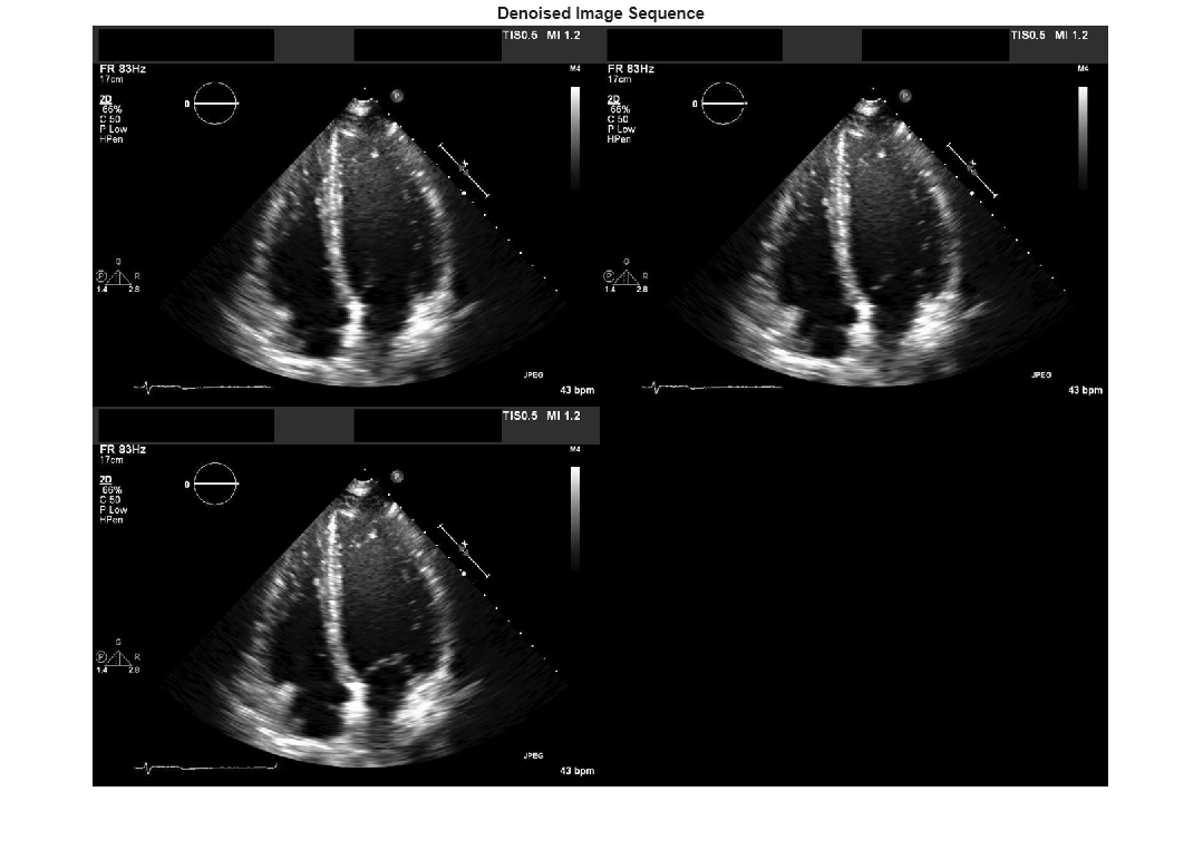 Figure contains an axes object. The hidden axes object with title Denoised Image Sequence contains an object of type image.