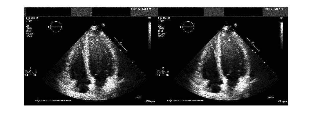 Figure contains an axes object. The hidden axes object contains an object of type image.
