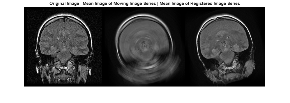 Figure contains an axes object. The hidden axes object with title Original Image | Mean Image of Moving Image Series | Mean Image of Registered Image Series contains an object of type image.