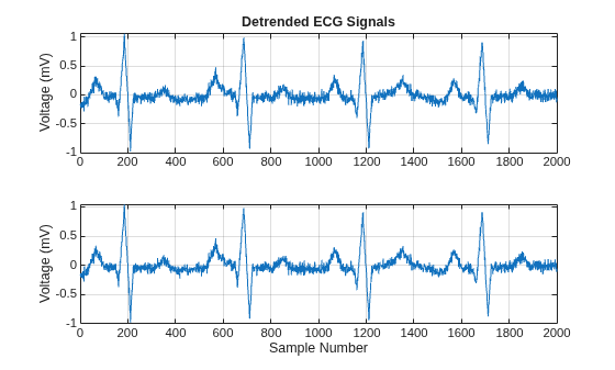 Figure contains 2 axes objects. Axes object 1 with title Detrended ECG Signals, ylabel Voltage (mV) contains an object of type line. Axes object 2 with xlabel Sample Number, ylabel Voltage (mV) contains an object of type line.