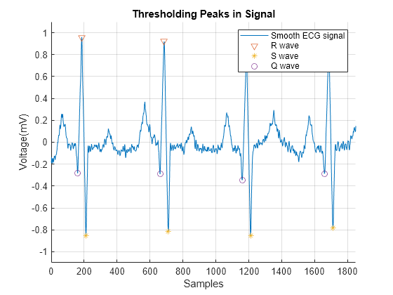 Q Signals Chart