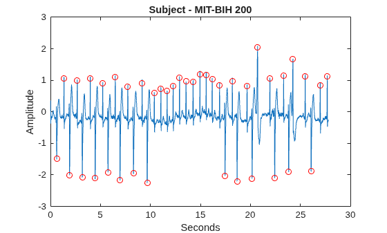 Figure contains an axes object. The axes object with title Subject - MIT-BIH 200, xlabel Seconds, ylabel Amplitude contains 2 objects of type line. One or more of the lines displays its values using only markers