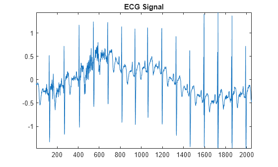 Figure contains an axes object. The axes object with title ECG Signal contains an object of type line.