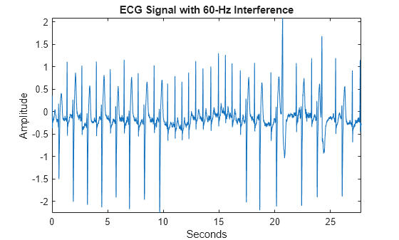 Figure contains an axes object. The axes object with title ECG Signal with 60-Hz Interference, xlabel Seconds, ylabel Amplitude contains an object of type line.