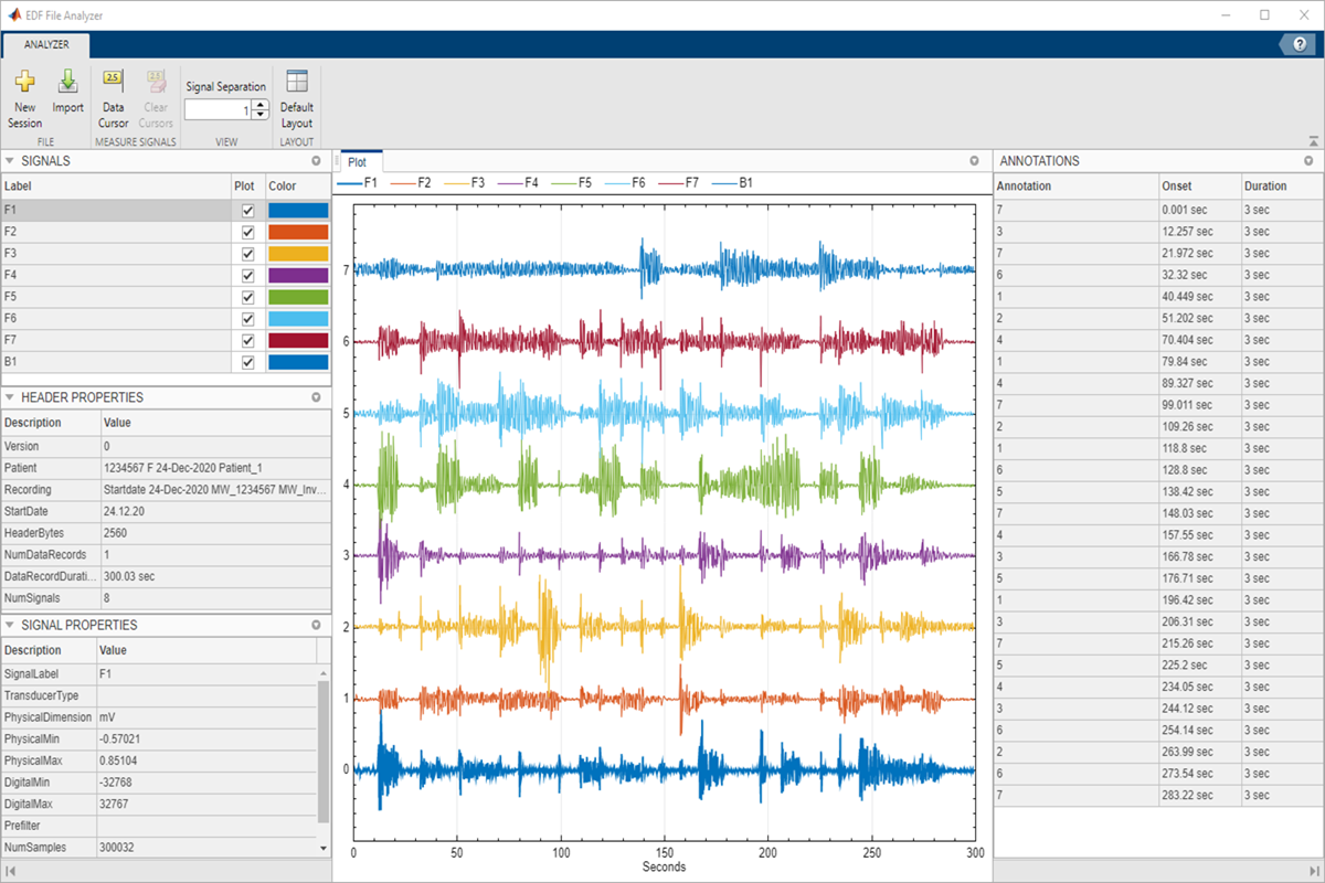 Matlab File Extension  Examples of Matlab File Extension