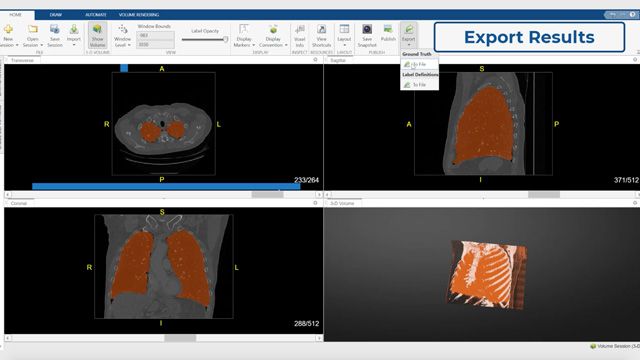 Display, Segment, and Process Medical Imaging Data with MATLAB - MATLAB